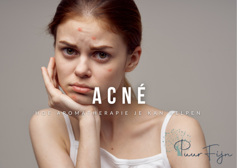 Aromatherapie bij acné